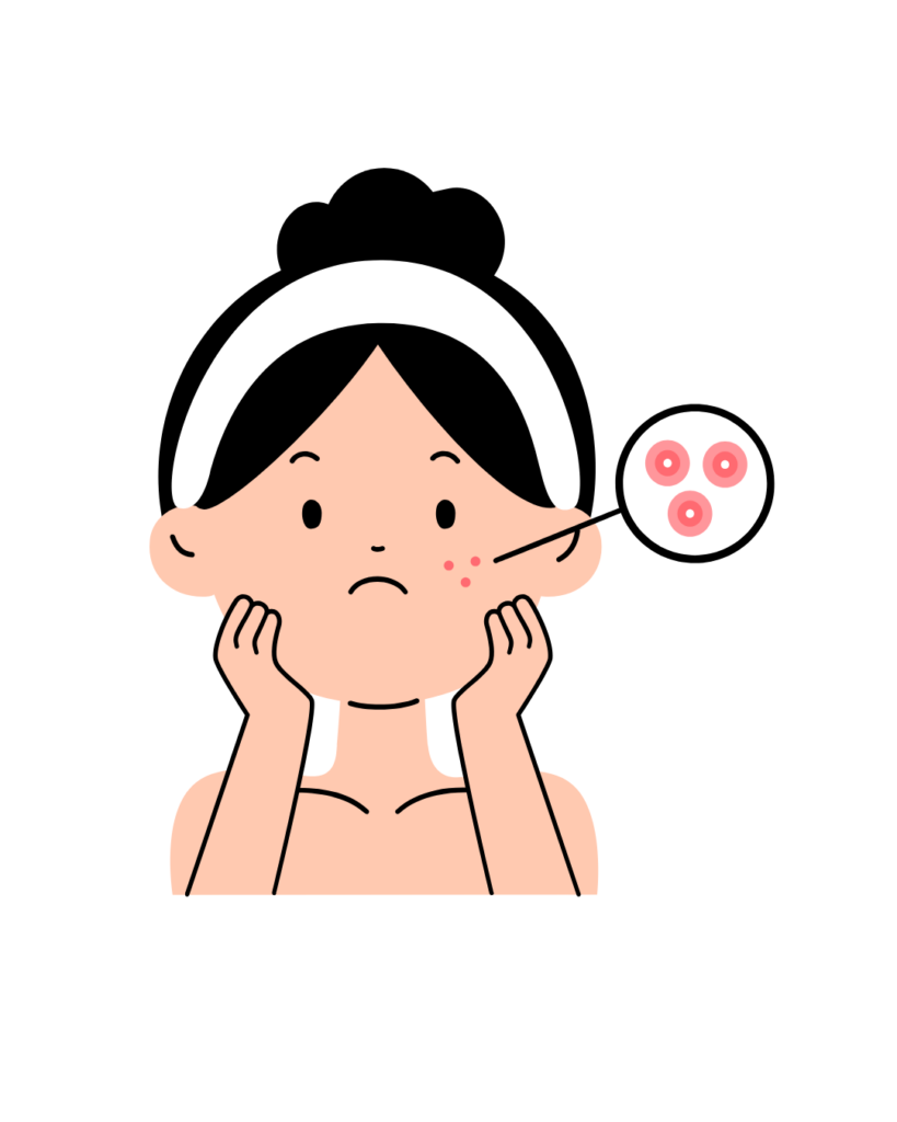 漢方でニキビ体質を改善する ふくろう薬局(静岡県島田市)